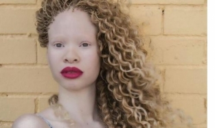 Африканка-альбинос Нотобеко Мбуязи назло недоброжелателям стала моделью