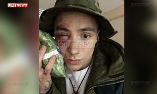 Солиста группы Quest Pistols избили в центре Киева 